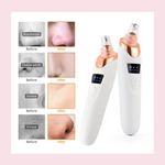 BeautyLights Pore Perfecter Pro