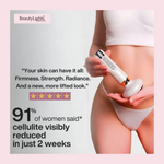 BeautyLights Anti-Cellulite Cupping Therapy Device